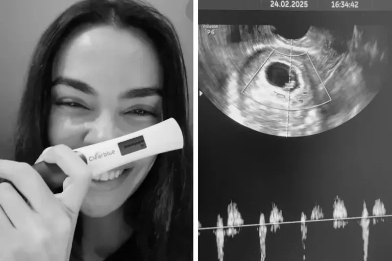 joana-sanz-1iv1k6xdsgg9u