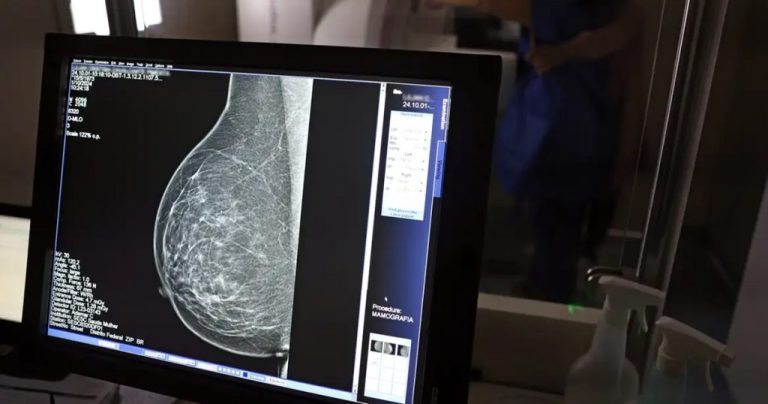 20250425_mamografia-1024x538