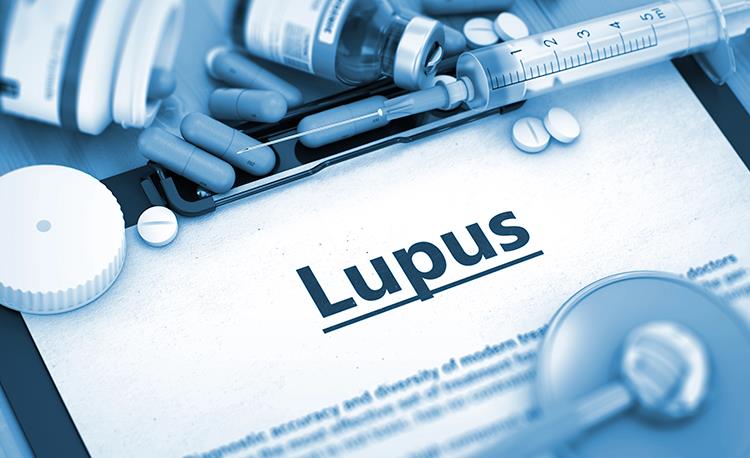 banner-portal-lupus-1