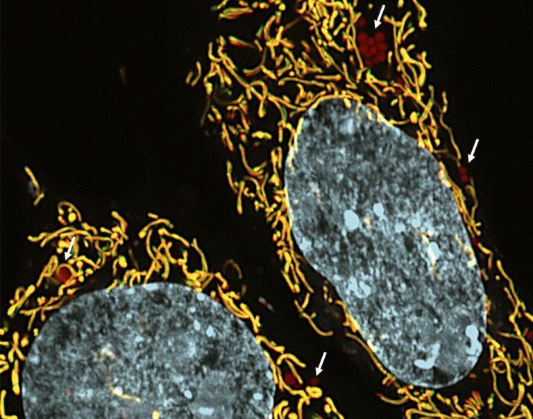 Pesquisa-revela-possibilidade-de-nova-terapia-com-medicamentos-contra-doencas-hereditarias-1024x805